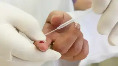 Lauro de Freitas inicia Dezembro Vermelho com testes e diálogo