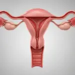 Endometriose afeta 1 em cada 10 mulheres e demanda aten&ccedil;&atilde;o no Abril Amarelo