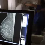 Lei reforça direito a 3 folgas anuais para exames preventivos de câncer